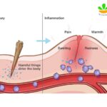 Khả năng kháng viêm của tinh dầu Kháng viêm